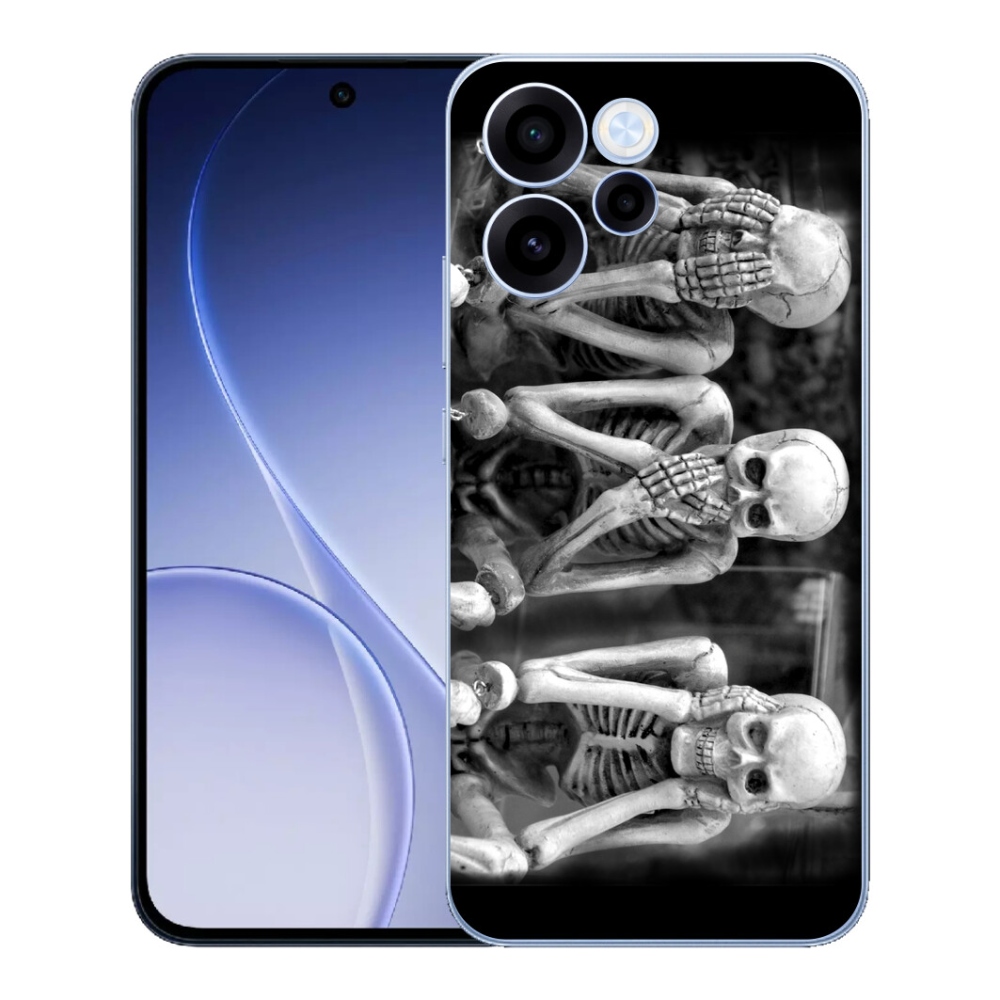 mmCase géltok az Oppo Reno 15 FS 5G-hez – csontvázak