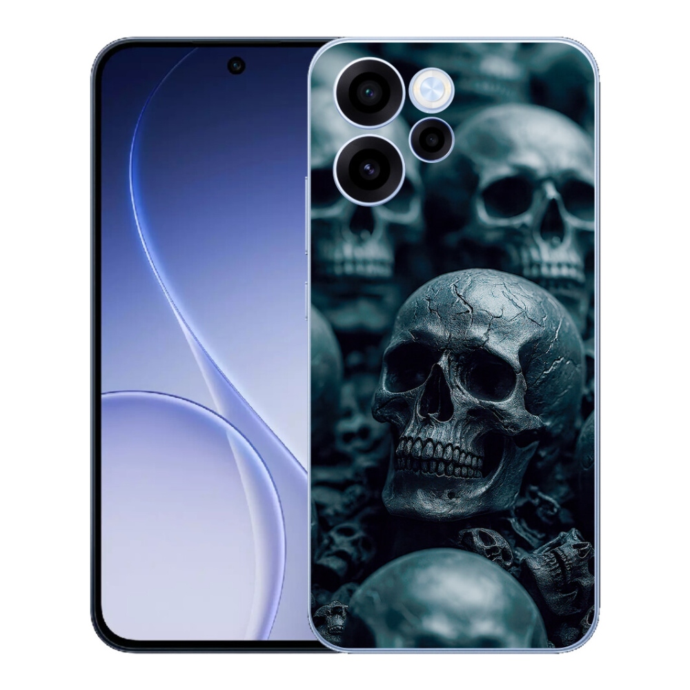 mmCase gél tok az Oppo Reno 15 FS 5G-hez – koponya 2