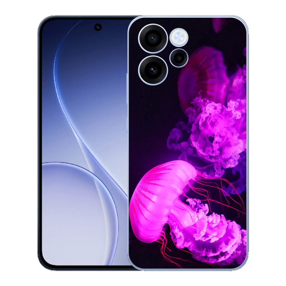 mmCase gél tok az Oppo Reno 15 FS 5G-hez – medúza 1