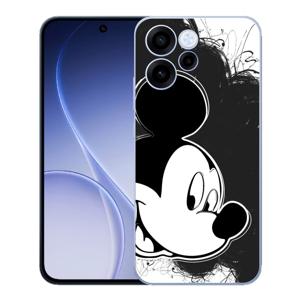 mmCase gél tok az Oppo Reno 15 FS 5G-hez – Mickey Mouse 1