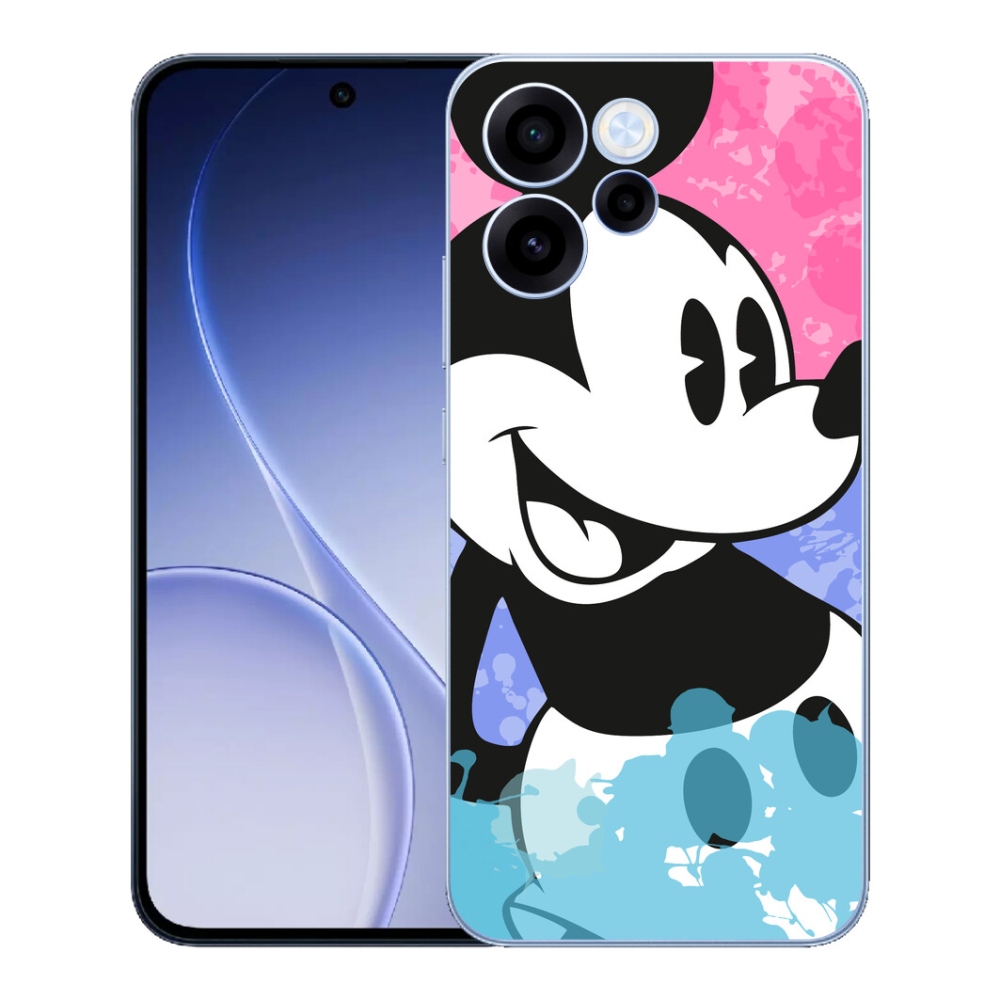 mmCase géltok az Oppo Reno 15 FS 5G-hez – Mickey Mouse