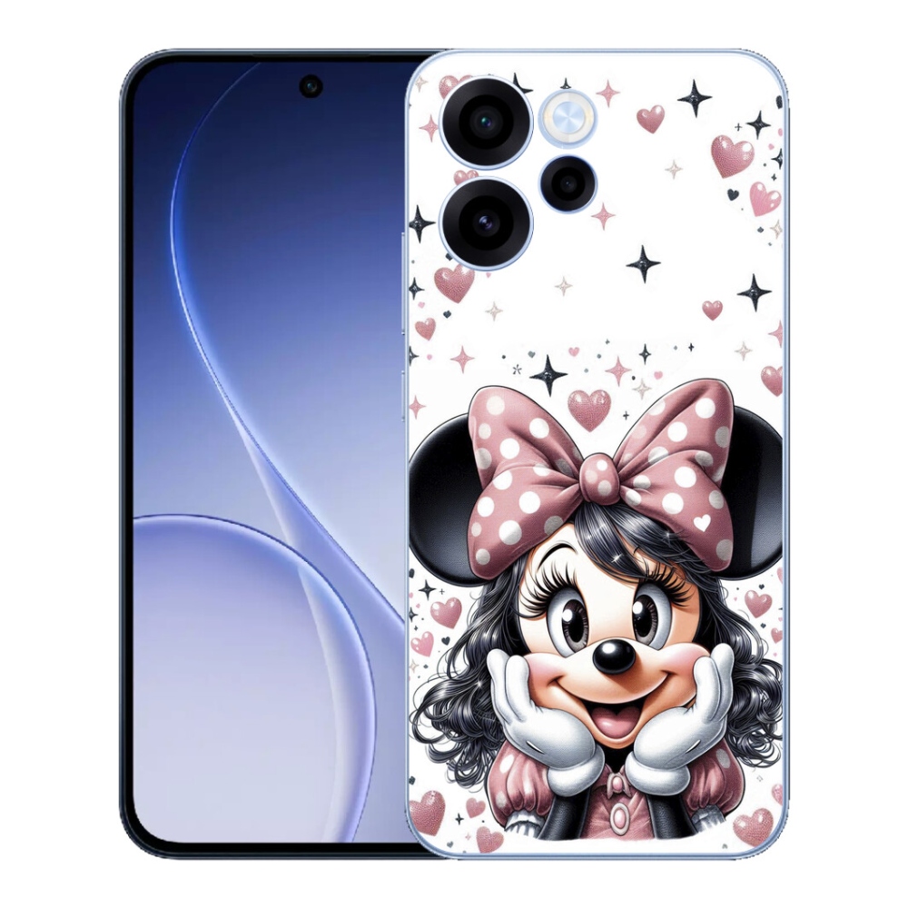 mmCase gélhuzat az Oppo Reno 15 FS 5G-hez – minnie
