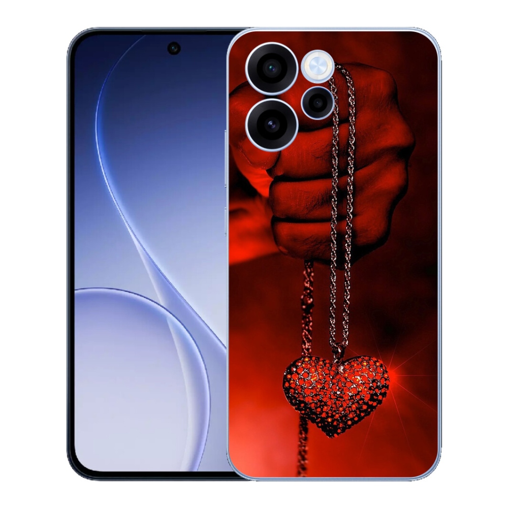 mmCase gél tok az Oppo Reno 15 FS 5G-hez – nyaklánc