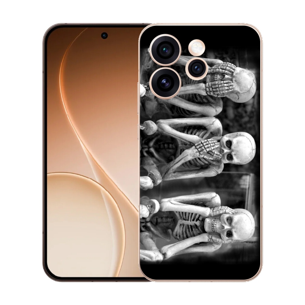 mmCase gél tok az Oppo Reno 15 Pro 5G-hez – csontvázak
