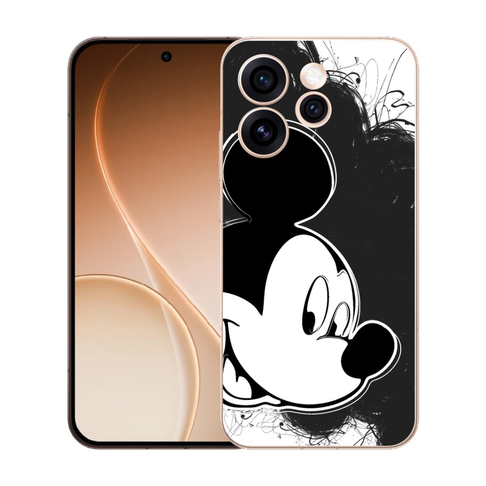mmCase gél tok az Oppo Reno 15 Pro 5G-hez – Mickey Mouse 1