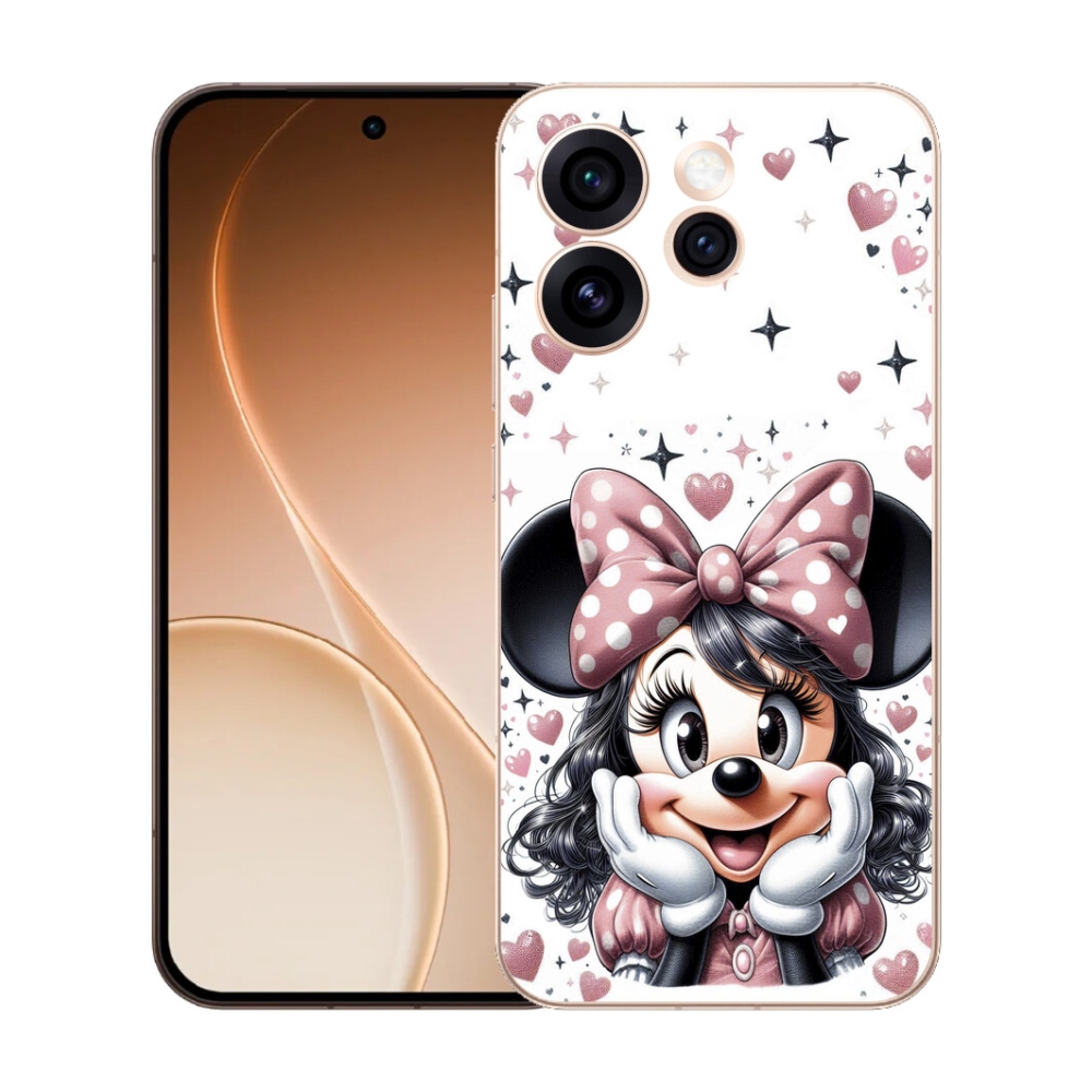 mmCase gél tok az Oppo Reno 15 Pro 5G-hez – minnie