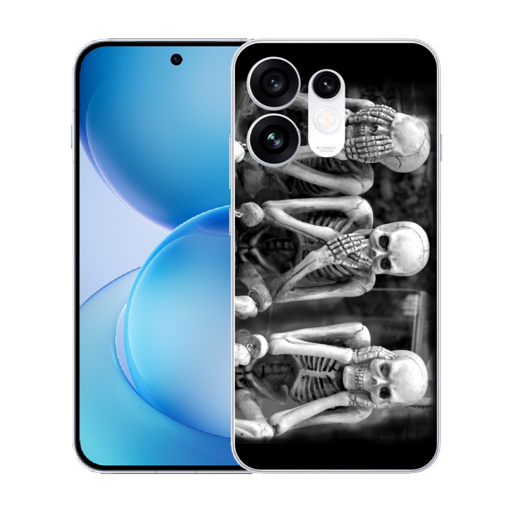 mmCase gélhuzat az Oppo Reno 16 5G-hez – csontvázak
