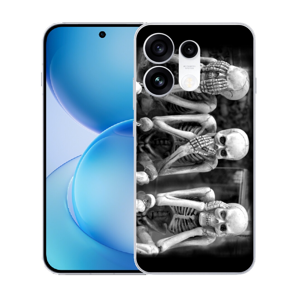 mmCase gél tok az Oppo Reno 16 Pro 5G-hez – csontvázak