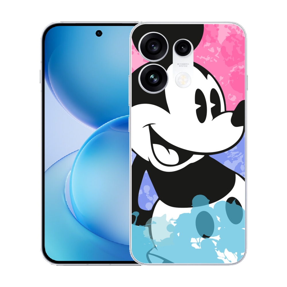 mmCase gél tok az Oppo Reno 16 Pro 5G-hez – Mickey Mouse