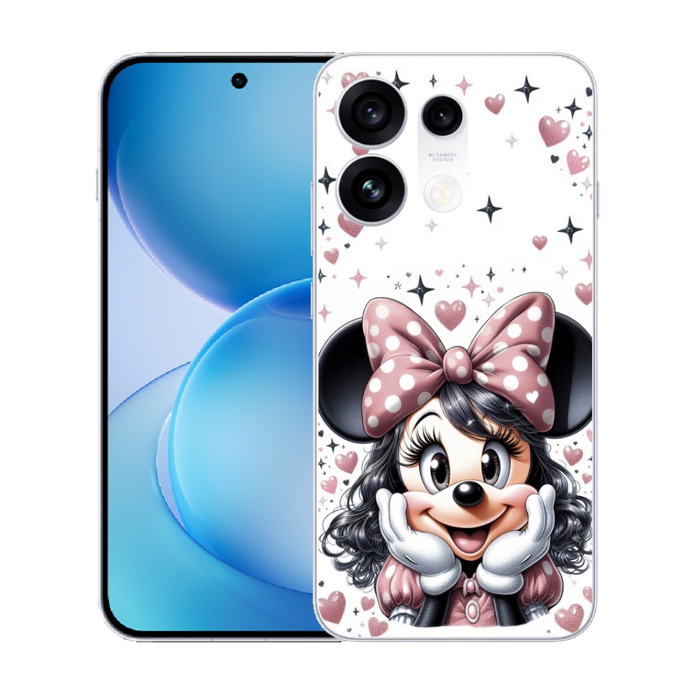mmCase gél tok az Oppo Reno 16 Pro 5G-hez – minnie