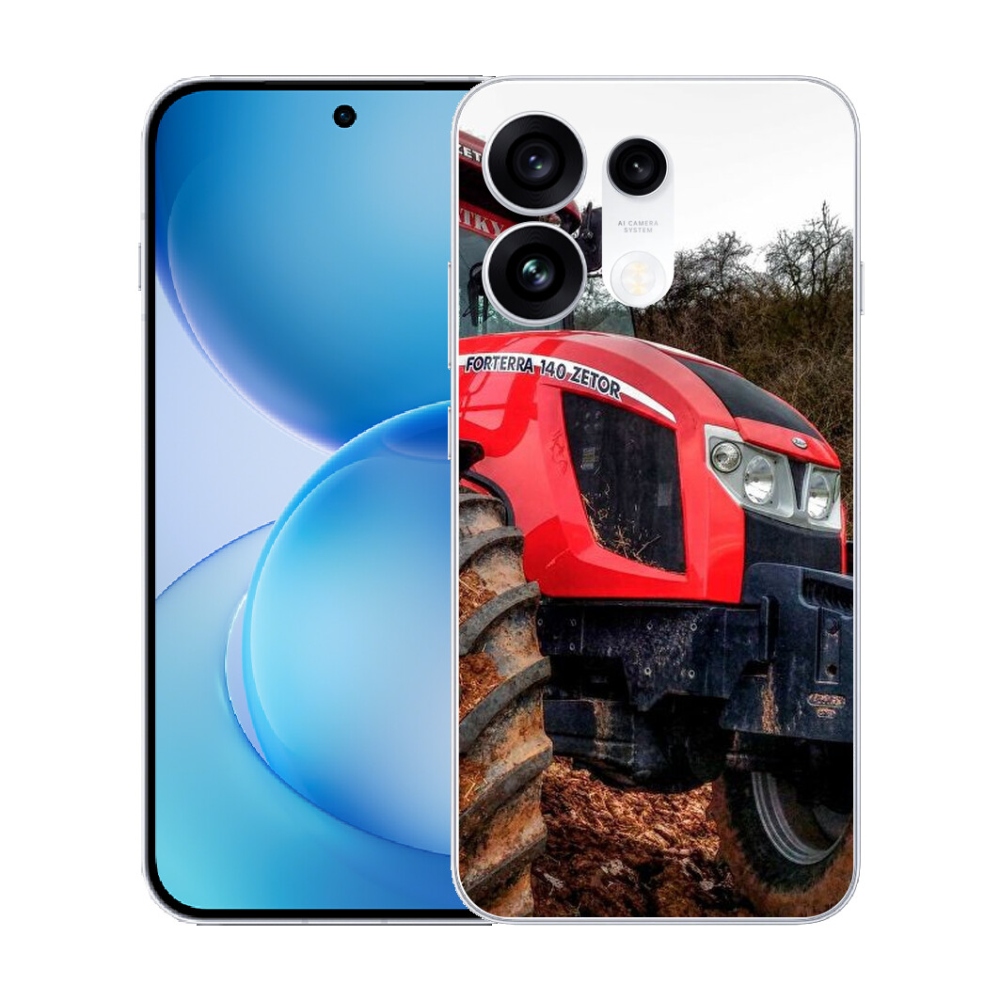 mmCase gél tok az Oppo Reno 16 Pro 5G-hez – zetor