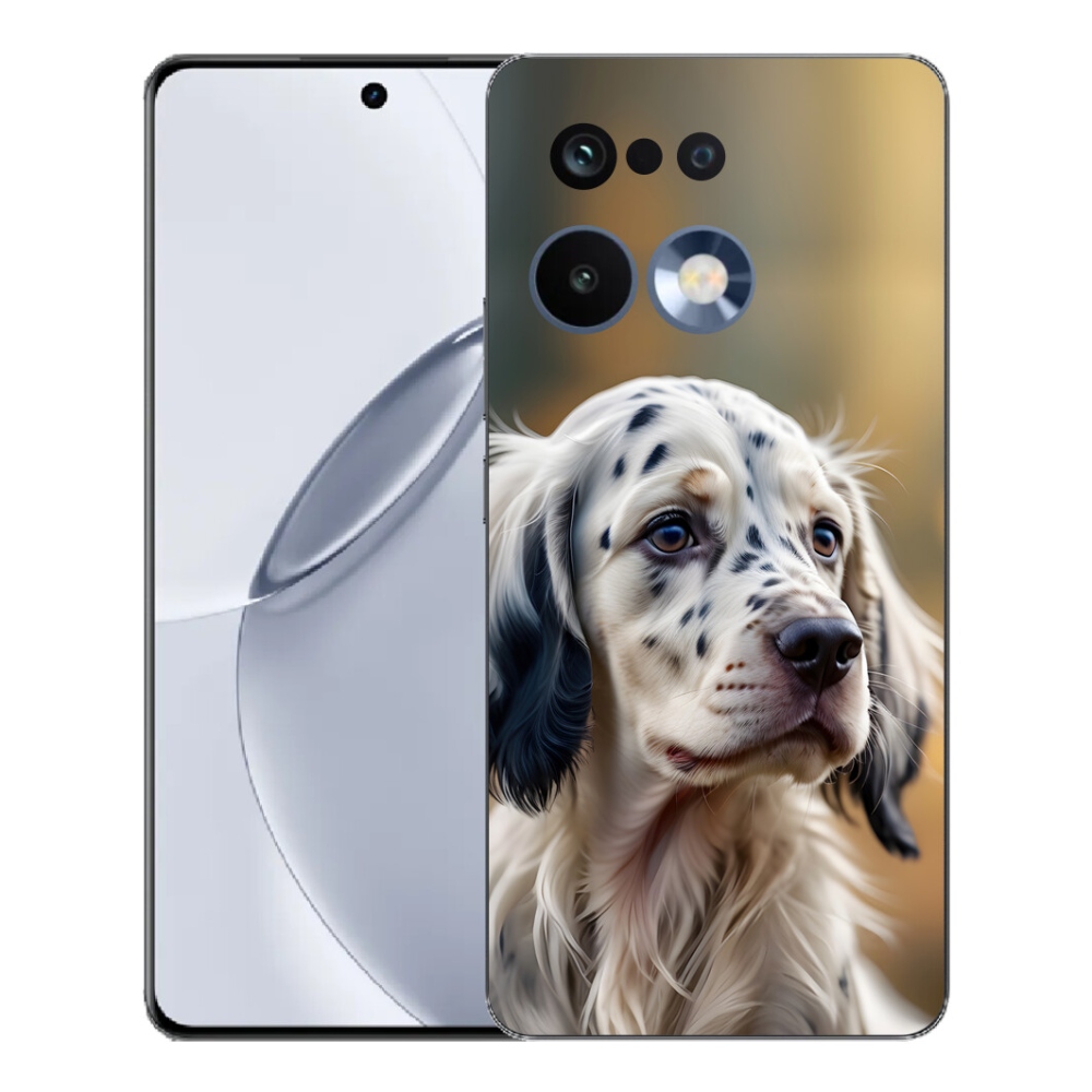 mmCase géltok a Realme 16 Pro+ készülékhez – angol szettr