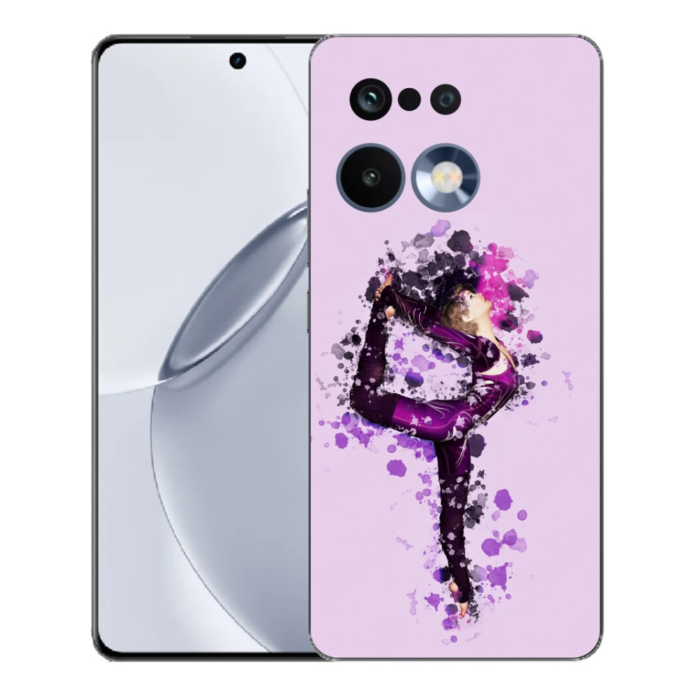 mmCase géltok a Realme 16 Pro+ készülékhez – balerina
