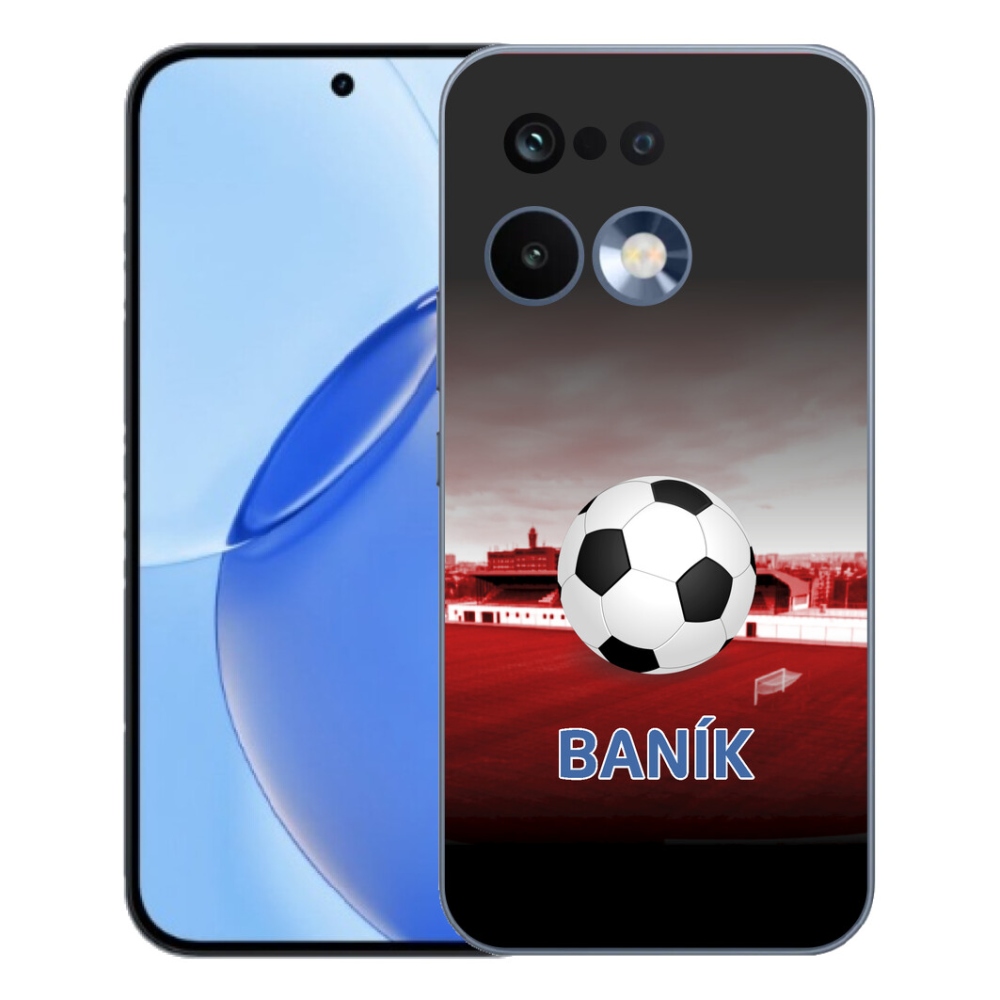 mmCase gél tok a Realme 16 Pro-hoz – bányász 1