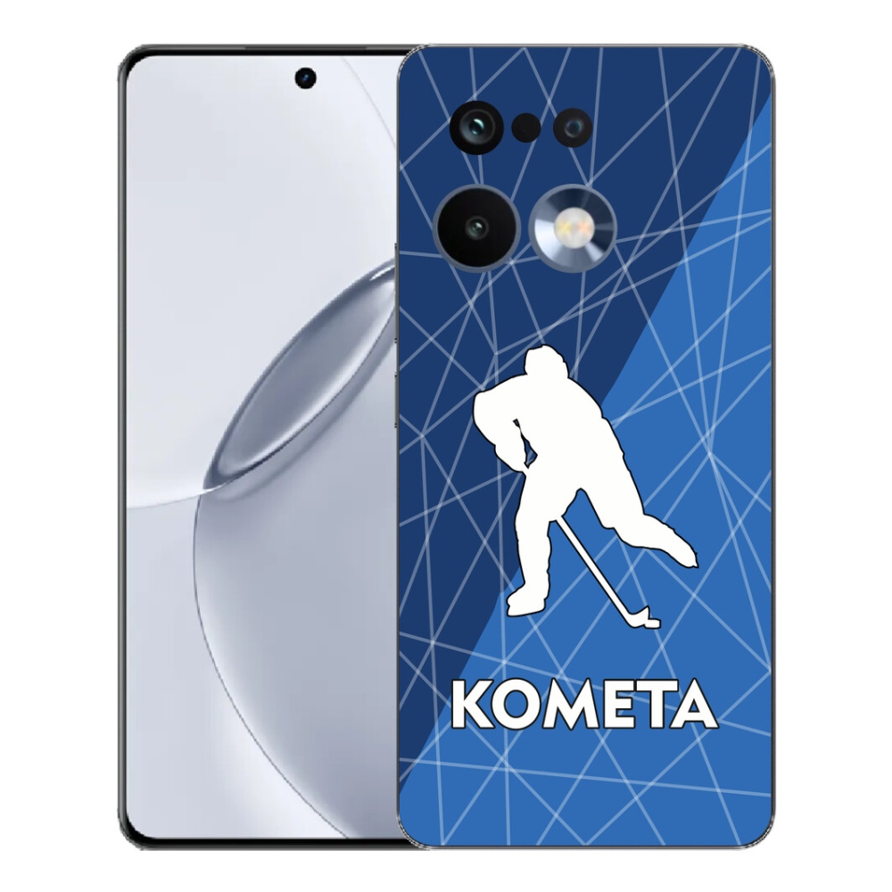 mmCase géltok a Realme 16 Pro+ készülékhez – Kometa