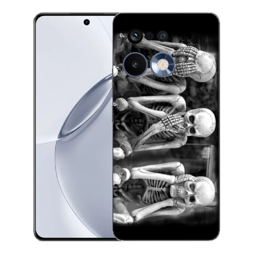 mmCase géltok a Realme 16 Pro+ készülékhez – csontvázak