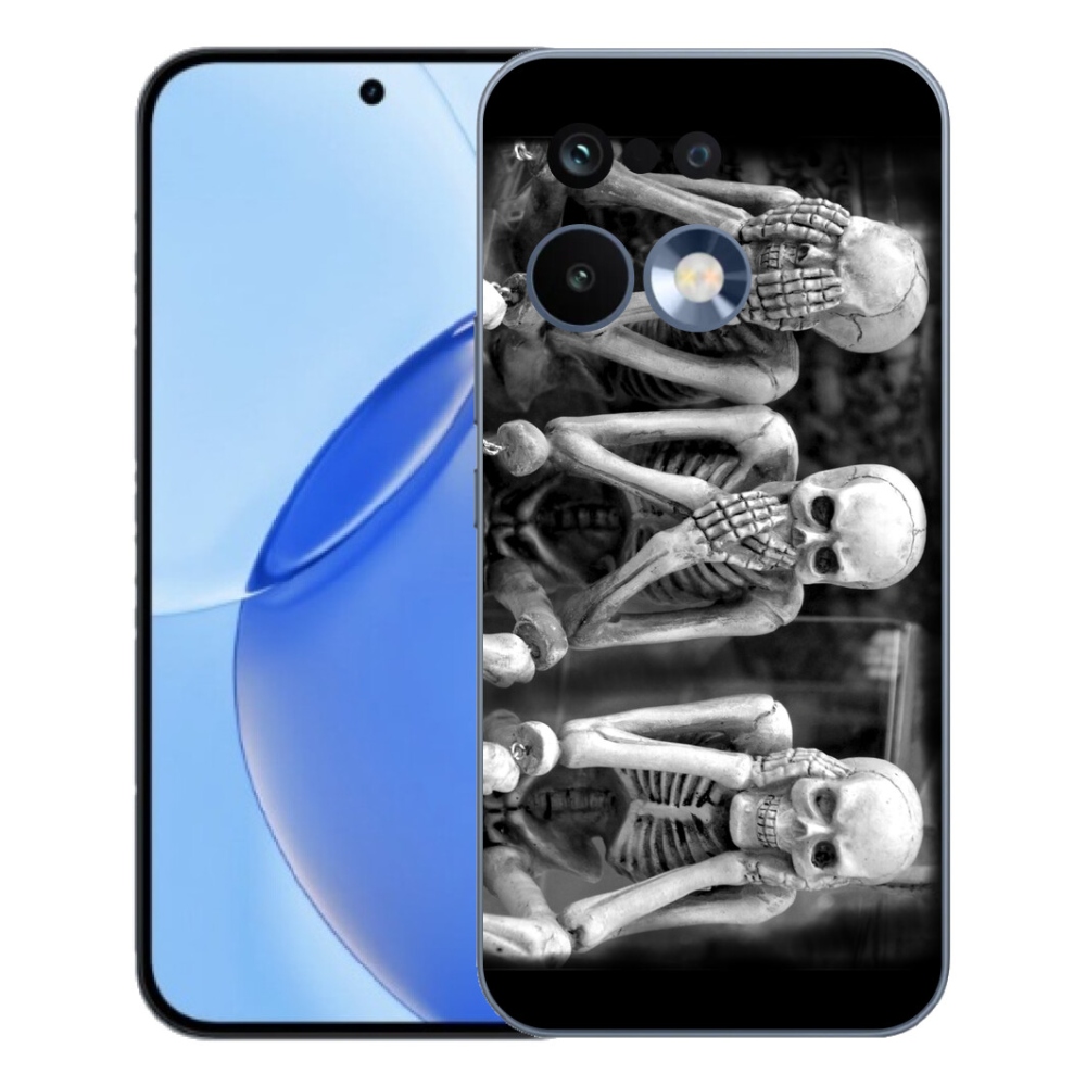 mmCase géltok a Realme 16 Pro-hoz – csontvázak
