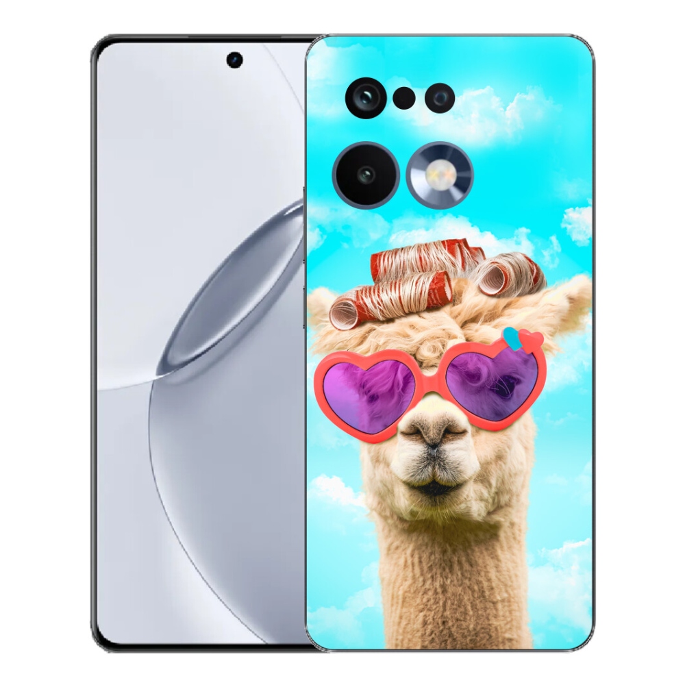 mmCase gél tok a Realme 16 Pro+ készülékhez – szemüveges láma