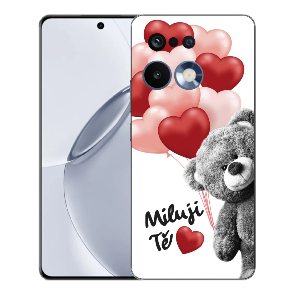 mmCase gélhuzat a Realme 16 Pro+ készülékhez – imádlak