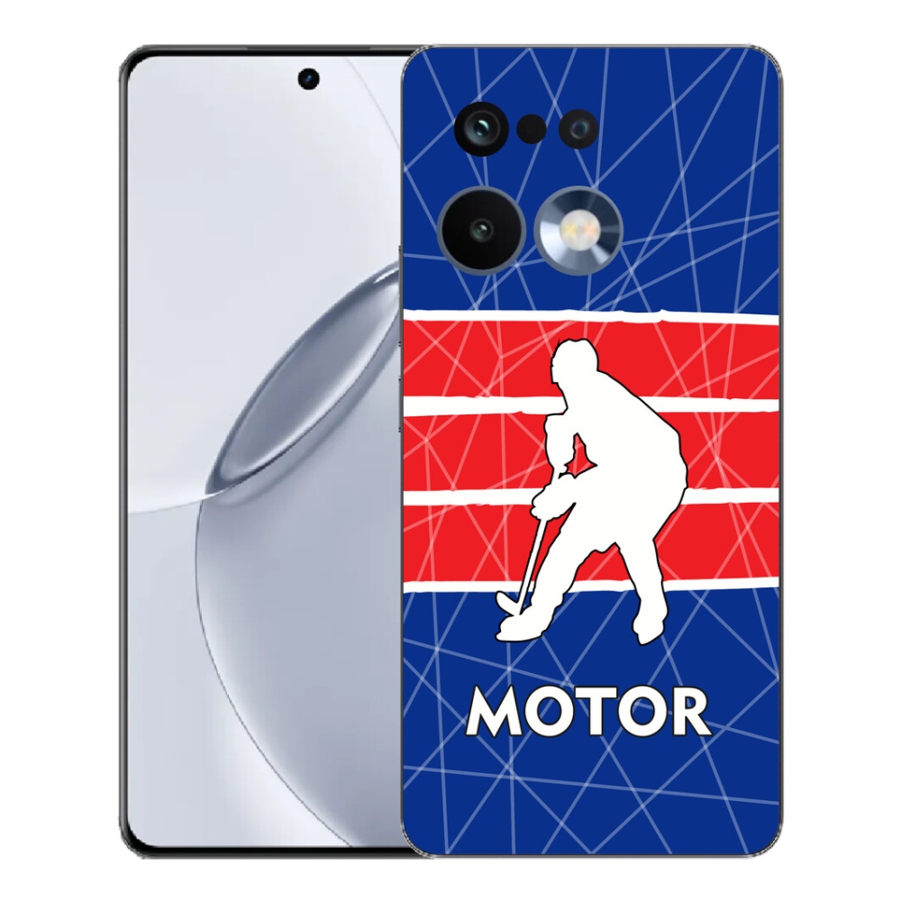 mmCase gélhuzat a Realme 16 Pro+ készülékhez – Motor