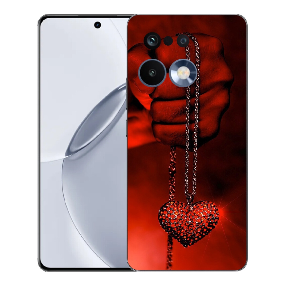 mmCase gél tok a Realme 16 Pro+ készülékhez – nyaklánc