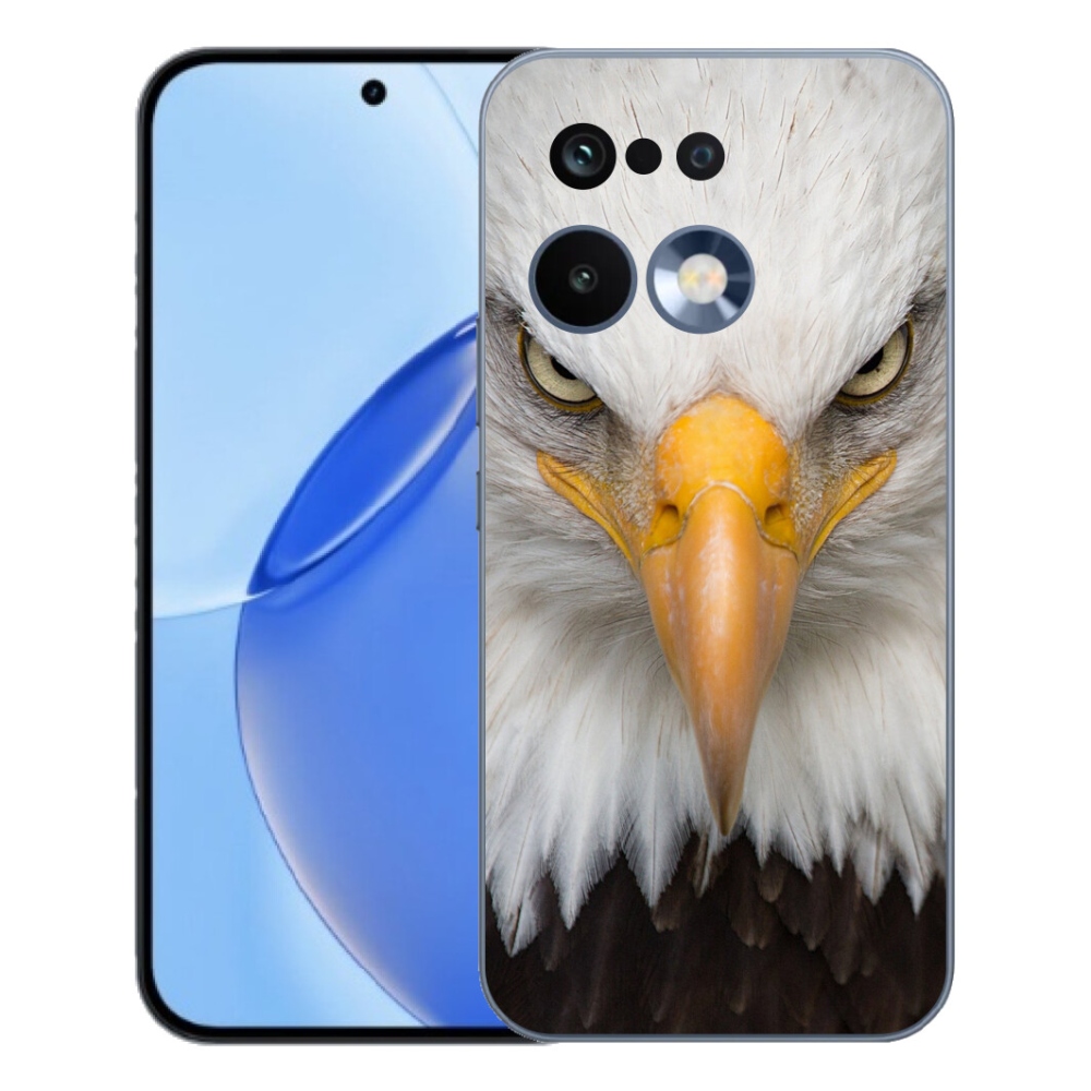 mmCase gélhuzat a Realme 16 Pro-hoz – sas