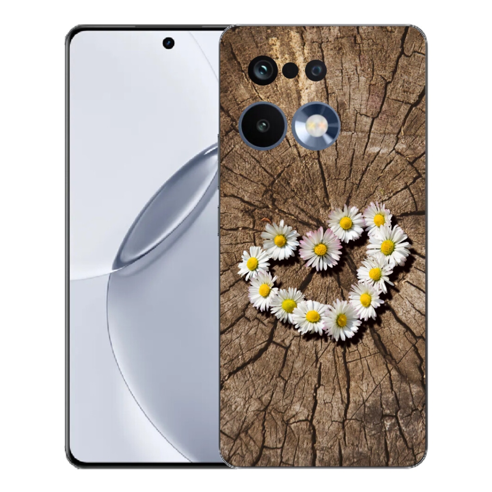 mmCase géltok a Realme 16 Pro+ készülékhez – margaréta mintás