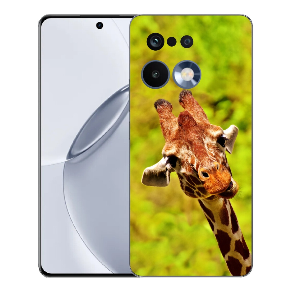 mmCase gélhuzat a Realme 16 Pro+ készülékhez – zsiráf