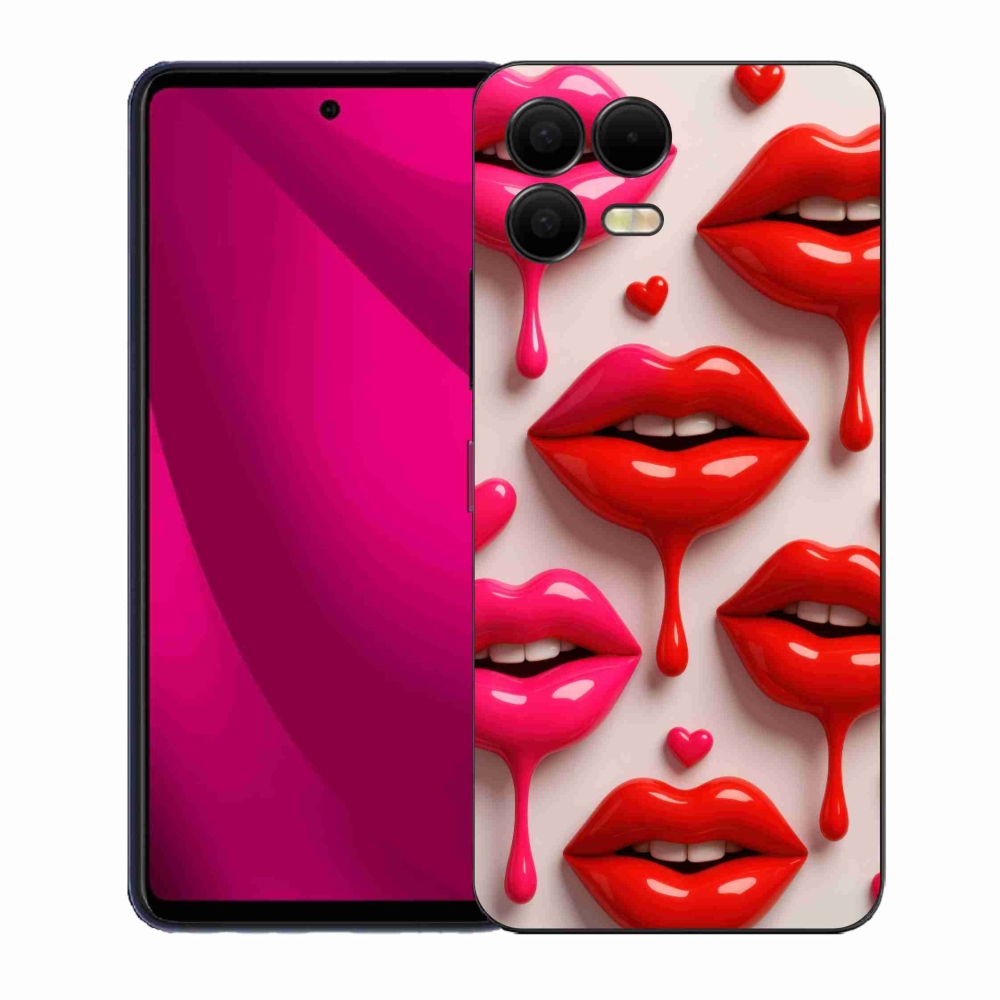 Gél borító mmCase a T phone 3 Pro készülékhez - ajkak 2