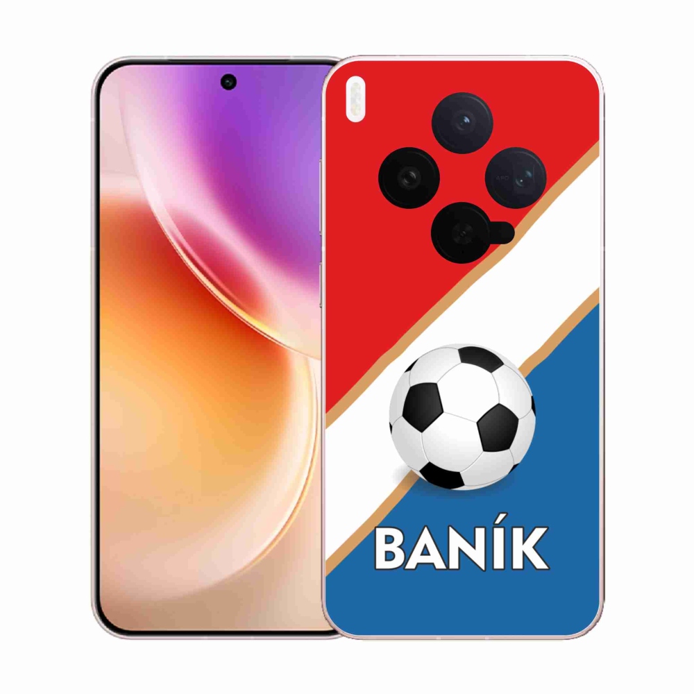 Zselés borítás mmCase a Vivo X300-hoz - Baník