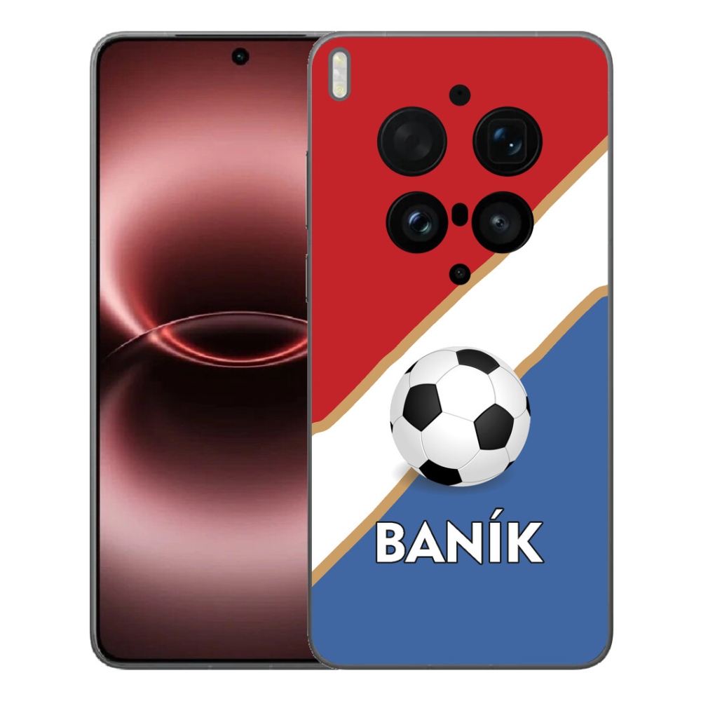 mmCase géltok a Vivo X300 Ultra-hoz – Baník