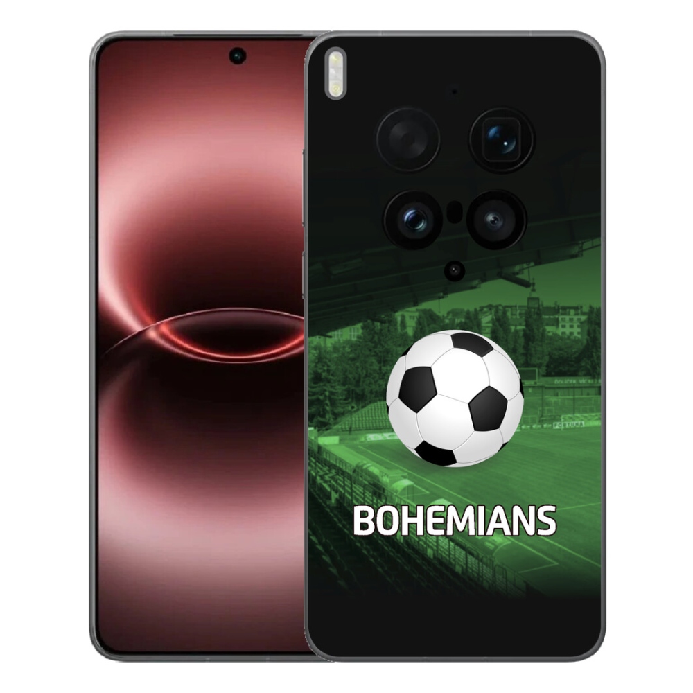 mmCase géltok a Vivo X300 Ultra-hoz – bohemians 1