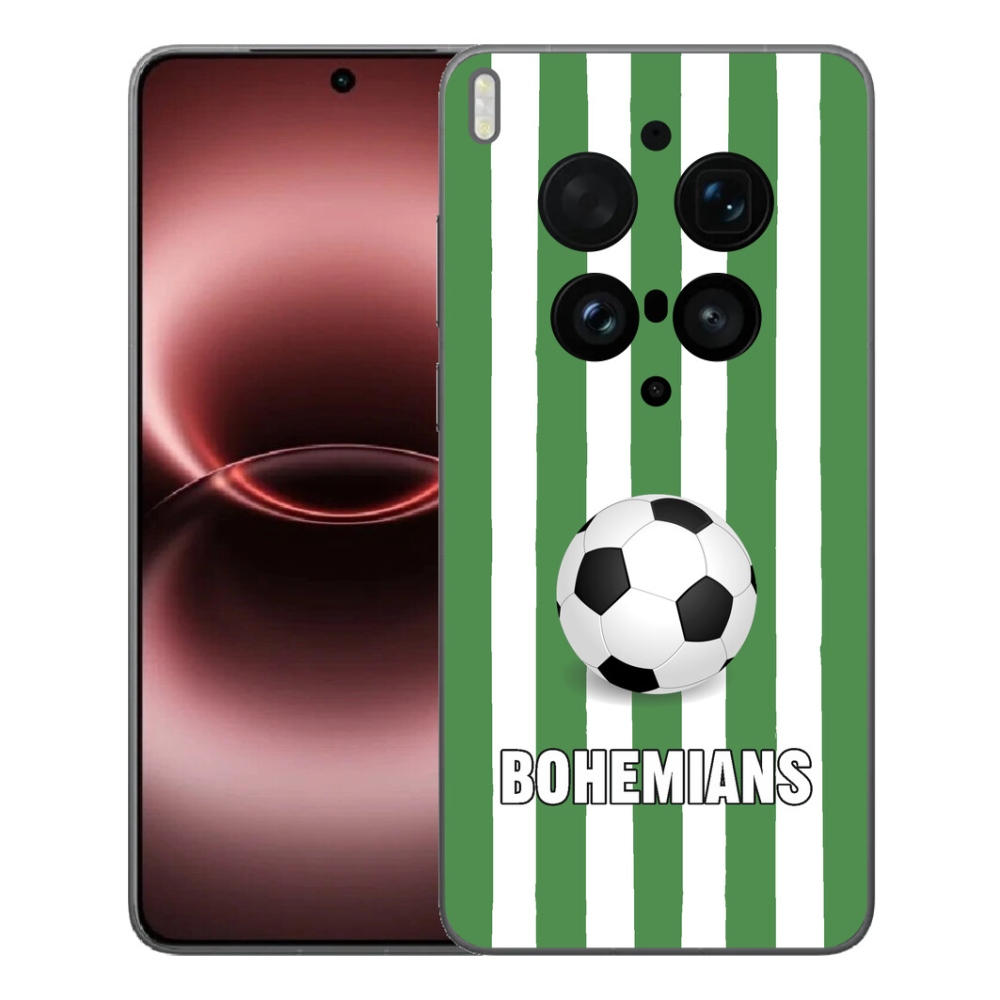 mmCase géltok a Vivo X300 Ultra-hoz – Bohemians