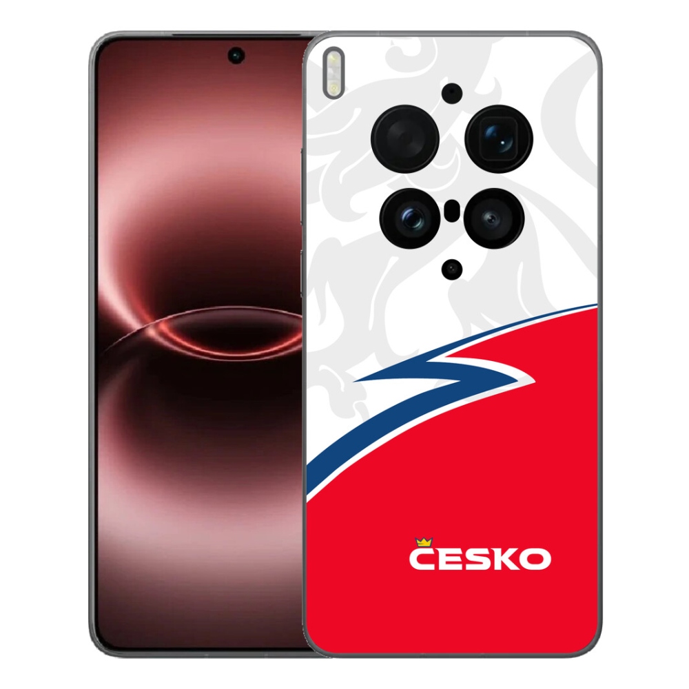 mmCase géltok a Vivo X300 Ultra-hoz – Csehország 1