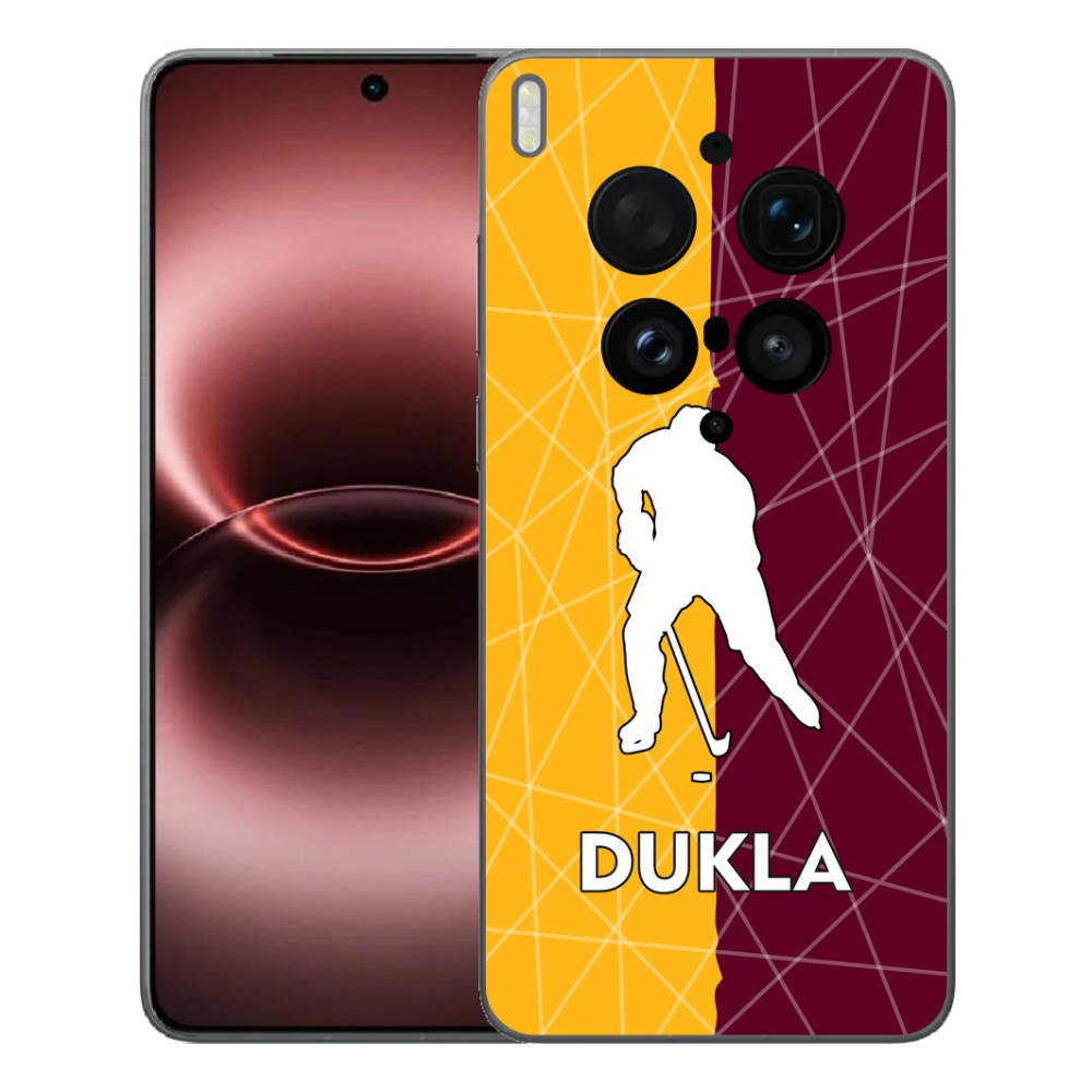 mmCase géltok a Vivo X300 Ultra-hoz – Dukla