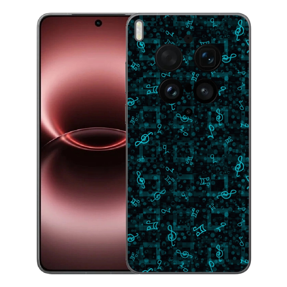 mmCase géltok a Vivo X300 Ultra-hoz – megjegyzések 1
