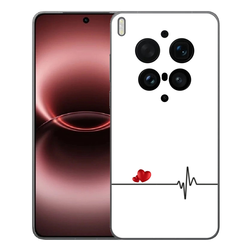 mmCase géltok a Vivo X300 Ultra-hoz – szív és pulzus fehér háttérrel