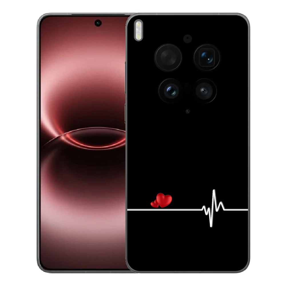 mmCase géltok a Vivo X300 Ultra-hoz – szív és pulzus fekete háttérrel