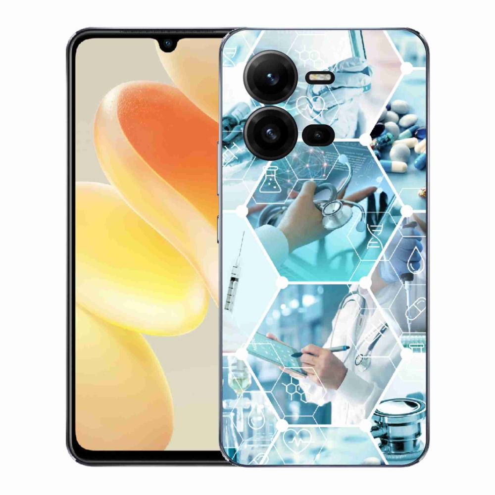 Gélburkolat mmCase a Vivo X80 Lite-on - egészség