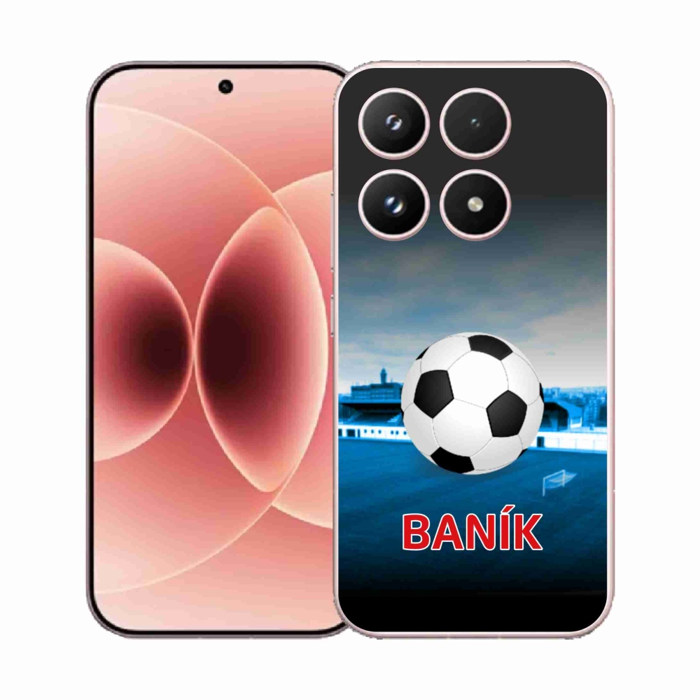 Gél borító mmCase a Xiaomi 17 - bányász 2 számára