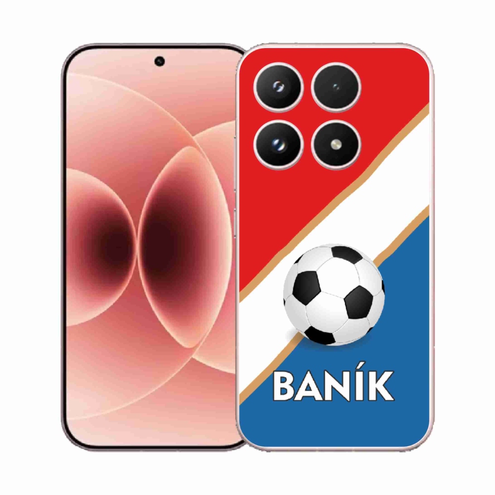 Gél borítás mmCase a Xiaomi 17-hez - Baník