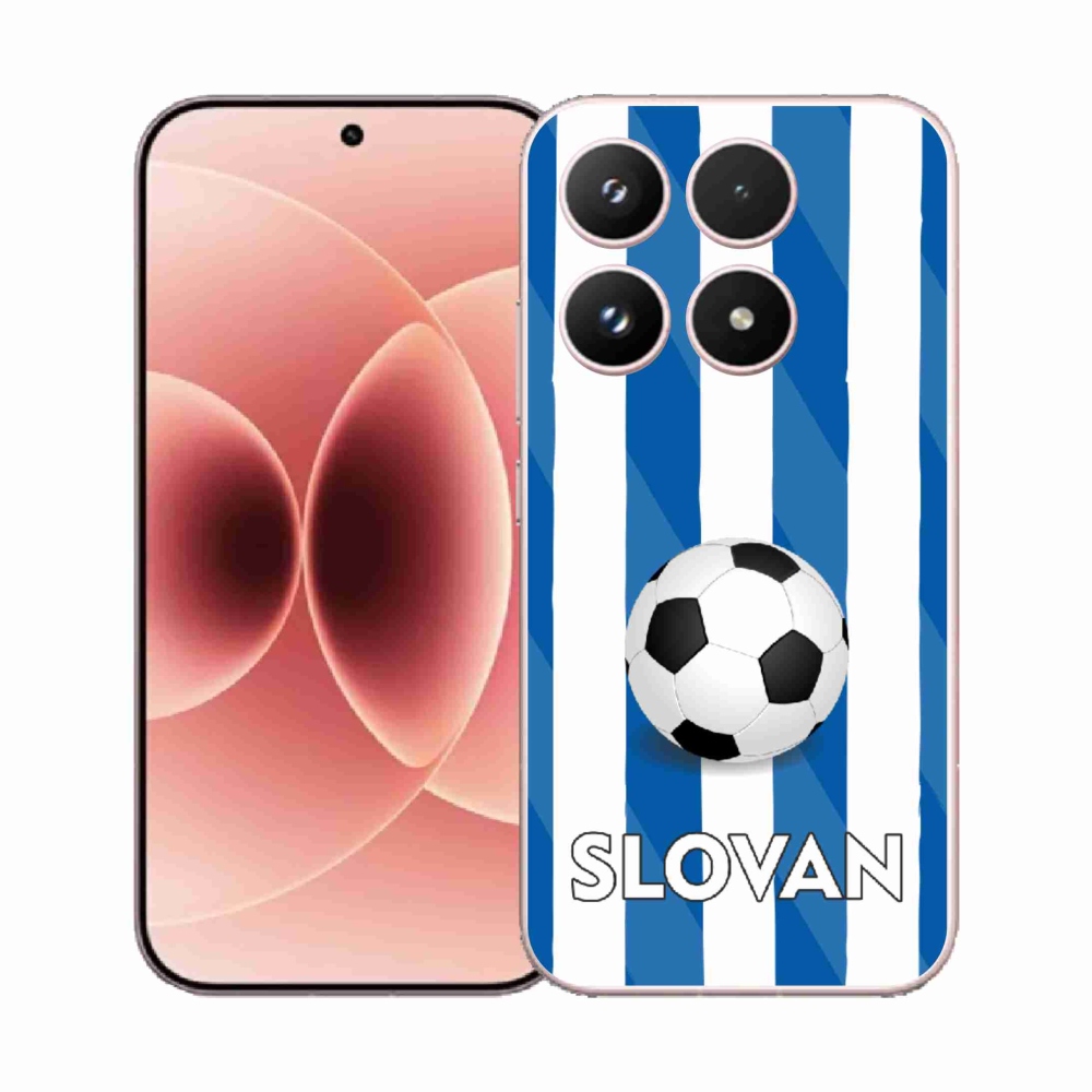 Gél borítás mmCase a Xiaomi 17-hez - Slovan