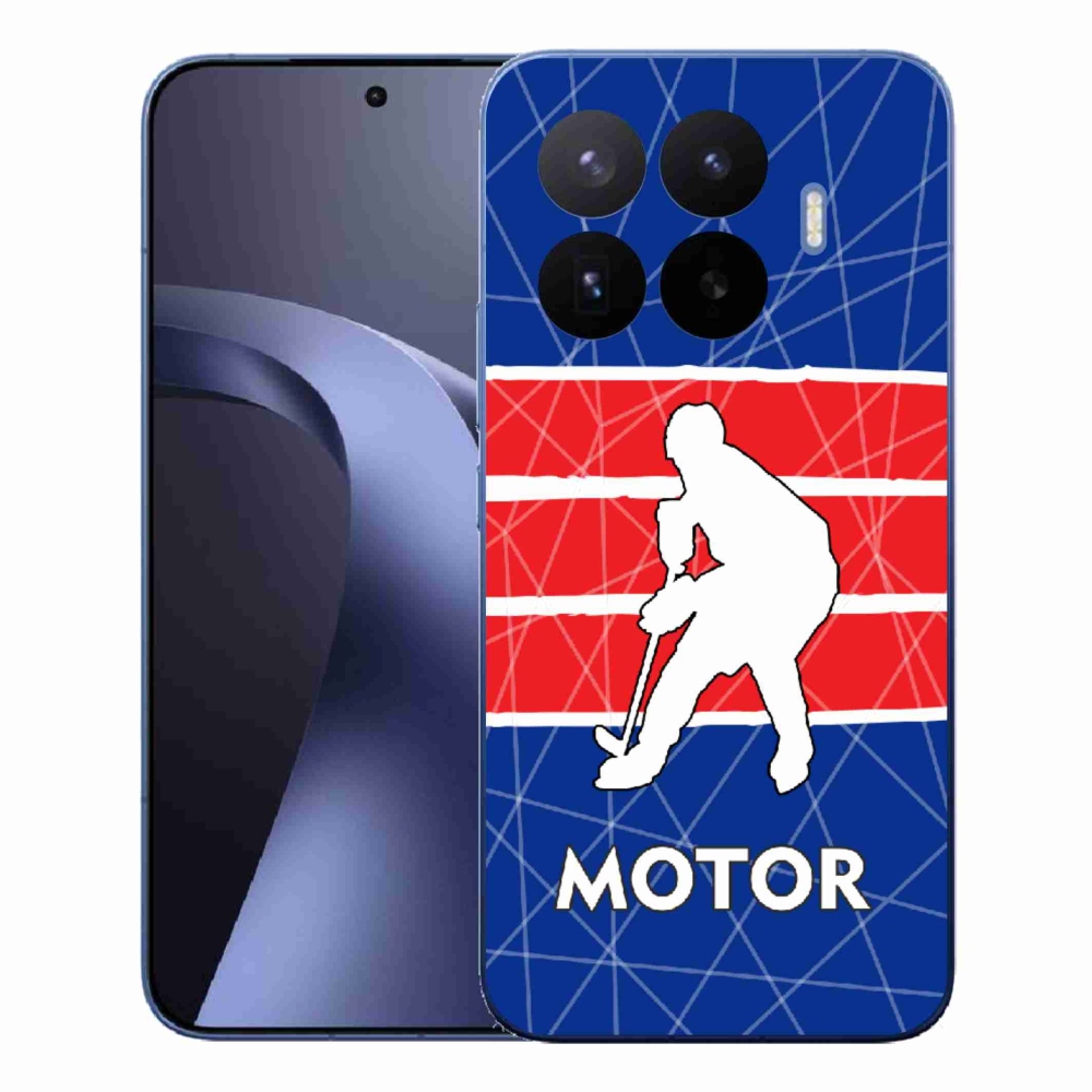 Gél borítás mmCase a Xiaomi 17T Pro - Motorhoz