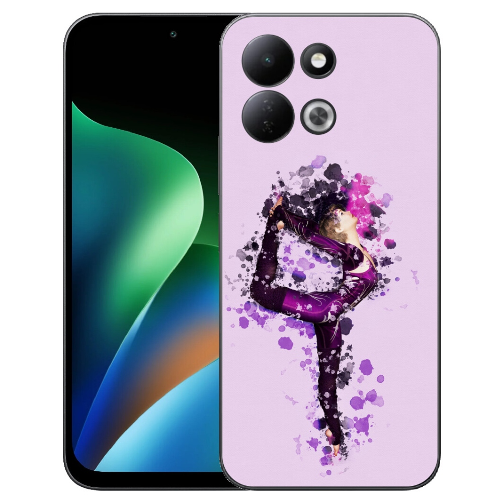 mmCase gélhuzat a Xiaomi Redmi 17 4G/5G-hez – balerina
