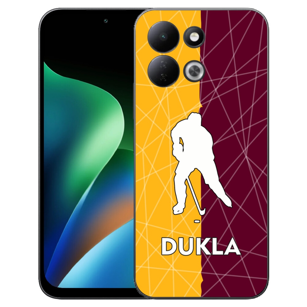 mmCase géltok a Xiaomi Redmi 17 4G/5G-hez – Dukla