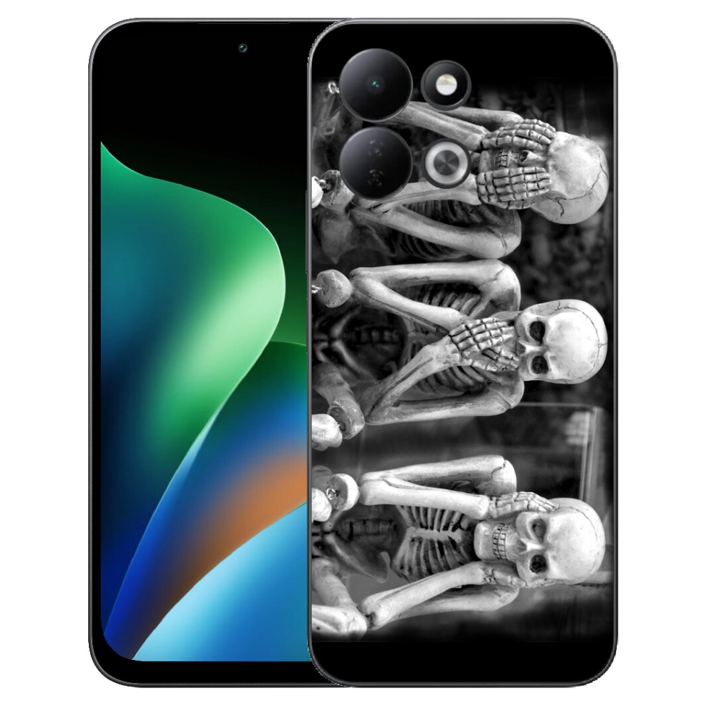 mmCase géltok a Xiaomi Redmi 17 4G/5G-hez – csontvázak