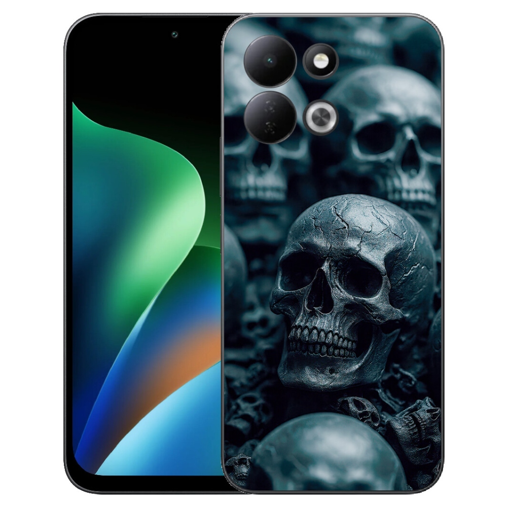 mmCase gél tok a Xiaomi Redmi 17 4G/5G-hez – koponya 2