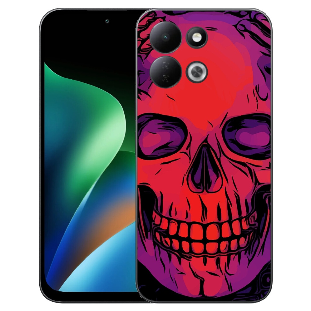mmCase géltok a Xiaomi Redmi 17 4G/5G-hez – koponya
