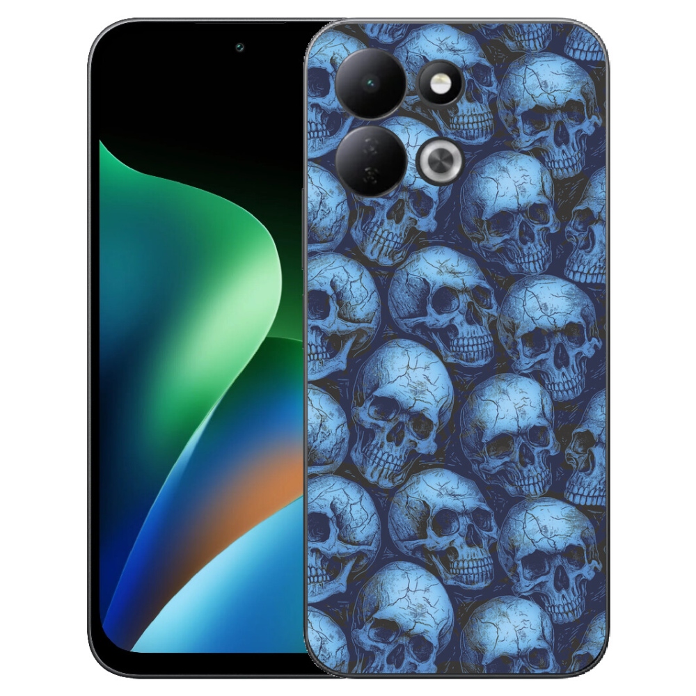 mmCase géltok a Xiaomi Redmi 17 4G/5G-hez – koponyák