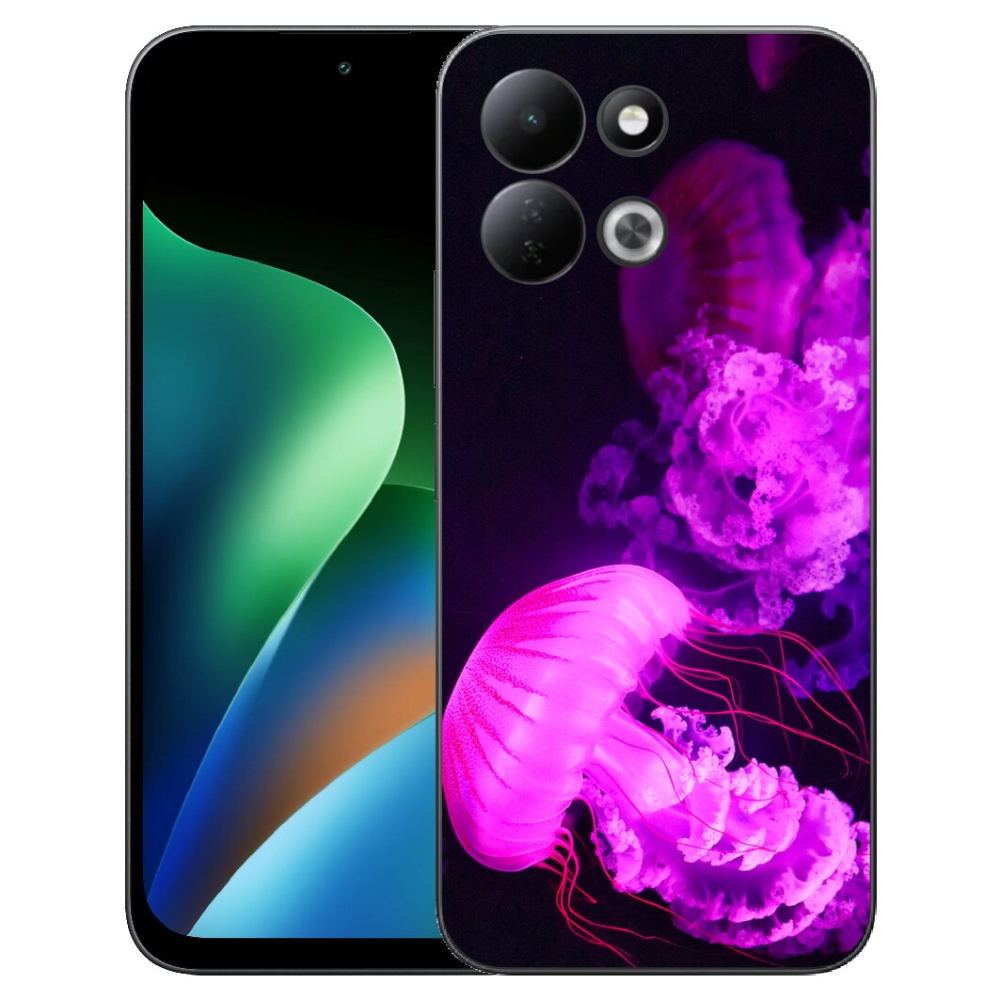 mmCase gél tok a Xiaomi Redmi 17 4G/5G-hez – medúza 1
